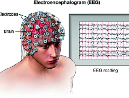 Understanding EEG Testing for Neurological Diagnoses