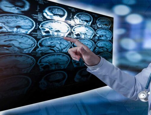 TMS Therapy: Enhancing Cognitive Health and Memory