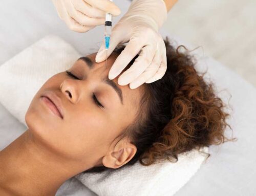 Botox for Migraines – What to Expect